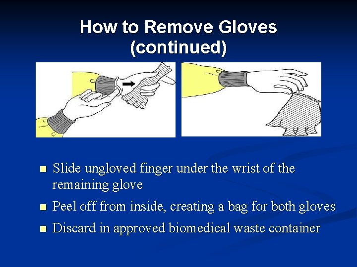 How to Remove Gloves (continued) n Slide ungloved finger under the wrist of the