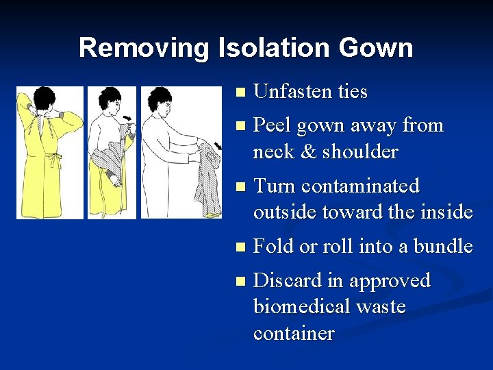 Removing Isolation Gown n Unfasten ties n Peel gown away from neck & shoulder