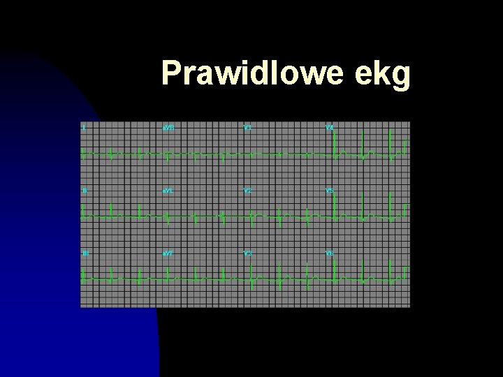 Prawidlowe ekg 