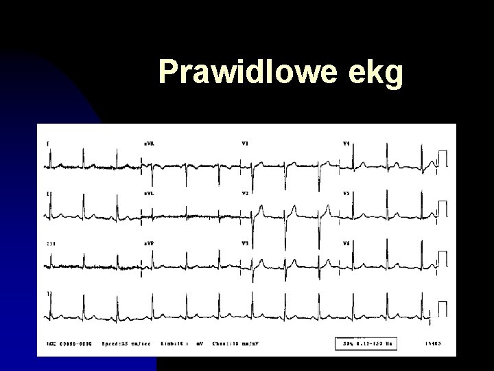 Prawidlowe ekg 