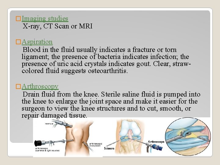 � Imaging studies X-ray, CT Scan or MRI � Aspiration Blood in the fluid