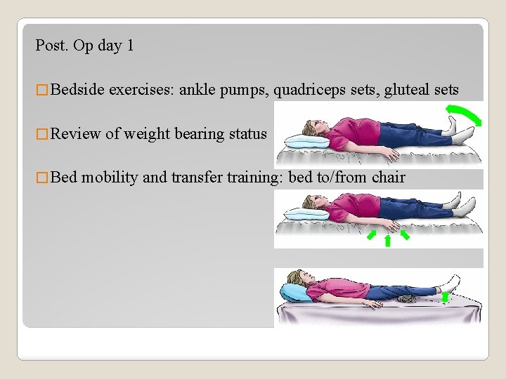 Post. Op day 1 � Bedside exercises: ankle pumps, quadriceps sets, gluteal sets �