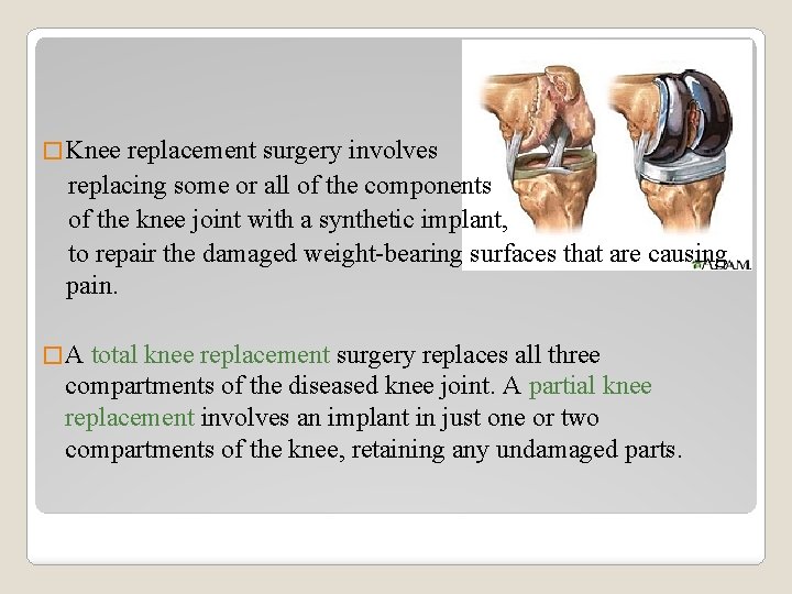 � Knee replacement surgery involves replacing some or all of the components of the