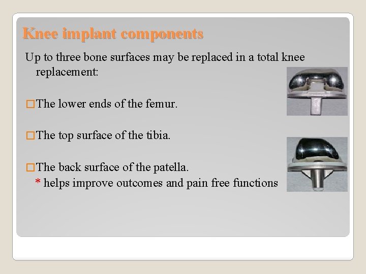 Knee implant components Up to three bone surfaces may be replaced in a total