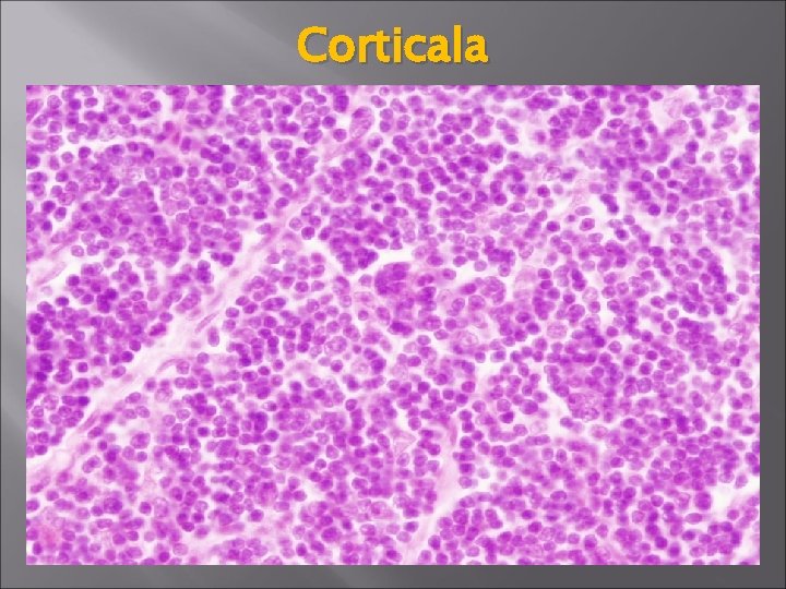 Corticala 