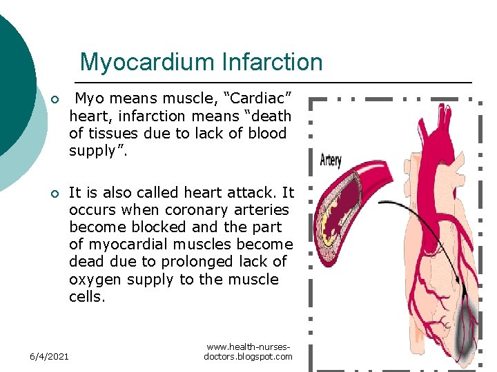 Myocardium Infarction ¡ Myo means muscle, “Cardiac” heart, infarction means “death of tissues due