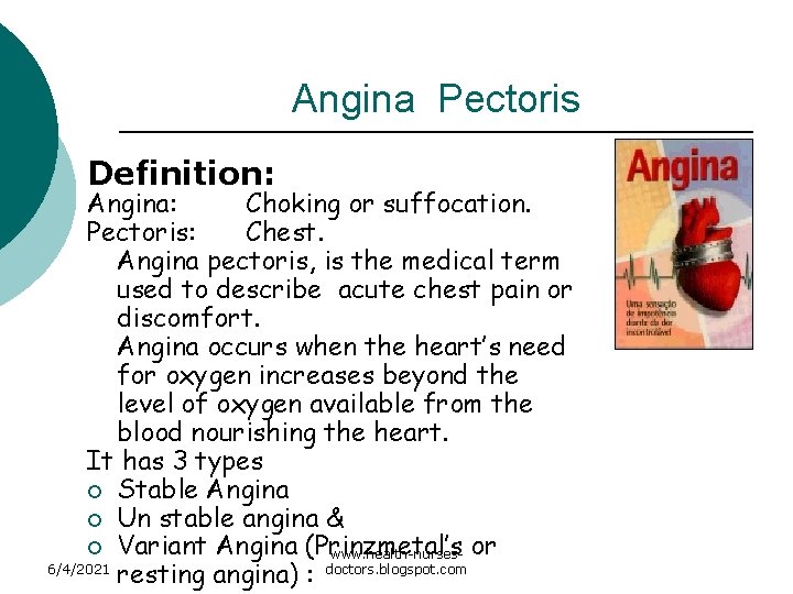Angina Pectoris Definition: Angina: Choking or suffocation. Pectoris: Chest. Angina pectoris, is the medical