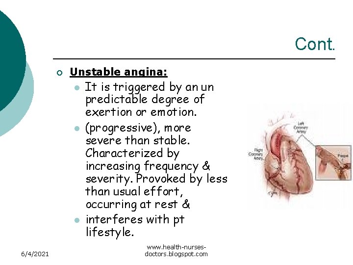 Cont. ¡ Unstable angina: l l l 6/4/2021 It is triggered by an un