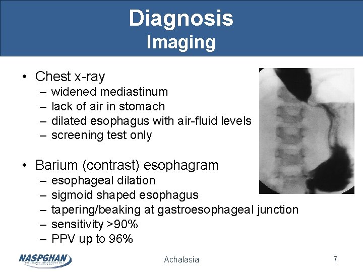Diagnosis Imaging • Chest x-ray – – widened mediastinum lack of air in stomach Diagnosis Imaging • Chest x-ray – – widened mediastinum lack of air in stomach