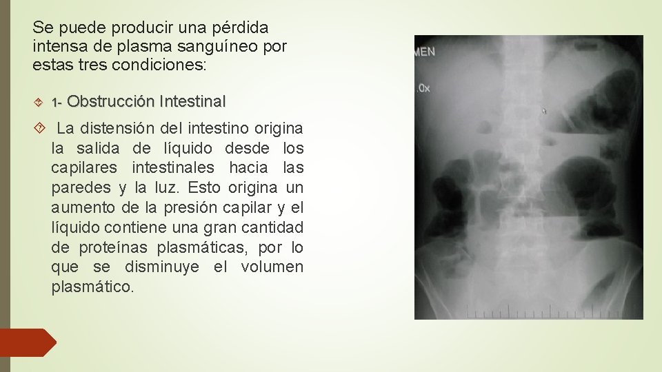 Se puede producir una pérdida intensa de plasma sanguíneo por estas tres condiciones: 1