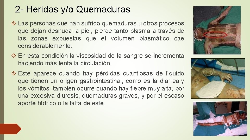 2 - Heridas y/o Quemaduras Las personas que han sufrido quemaduras u otros procesos