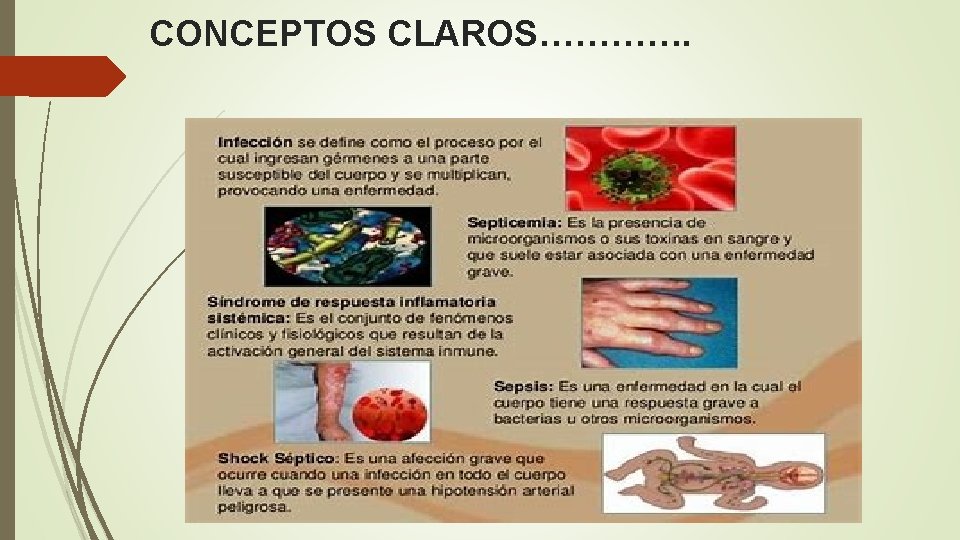 CONCEPTOS CLAROS…………. 