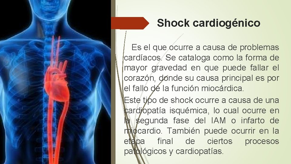 Shock cardiogénico Es el que ocurre a causa de problemas cardíacos. Se cataloga como