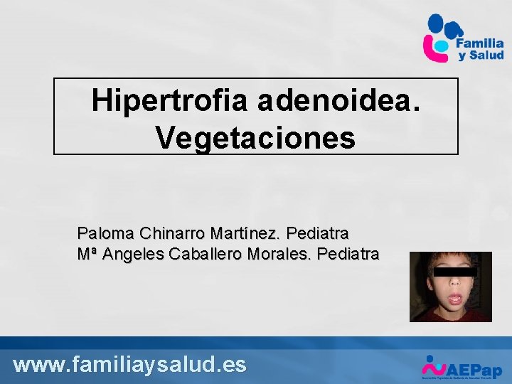 Hipertrofia adenoidea. Vegetaciones Paloma Chinarro Martínez. Pediatra Mª Angeles Caballero Morales. Pediatra www. familiaysalud.