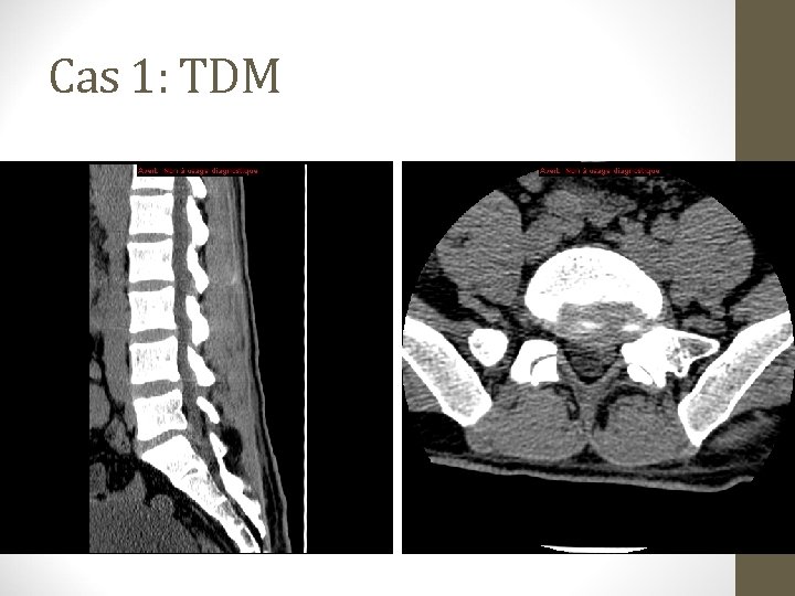 Cas 1: TDM Cas 1: TDM