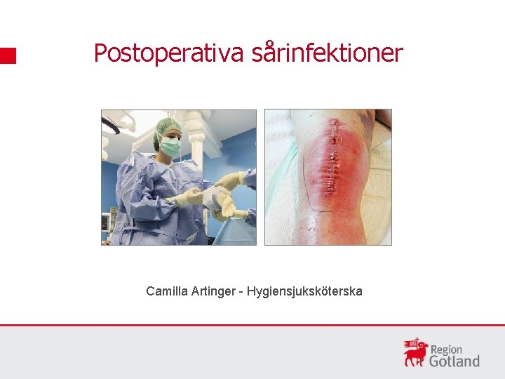 Postoperativa sårinfektioner Camilla Artinger - Hygiensjuksköterska 