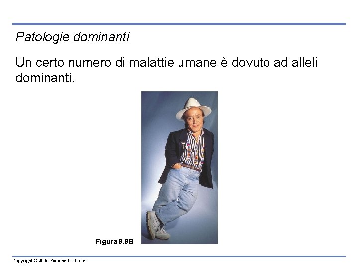 Patologie dominanti Un certo numero di malattie umane è dovuto ad alleli dominanti. Figura