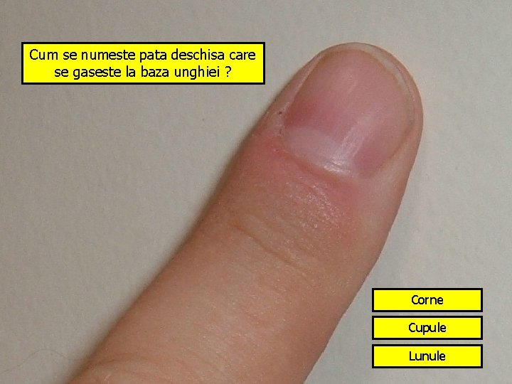 Cum se numeste pata deschisa care se gaseste la baza unghiei ? Corne Cupule