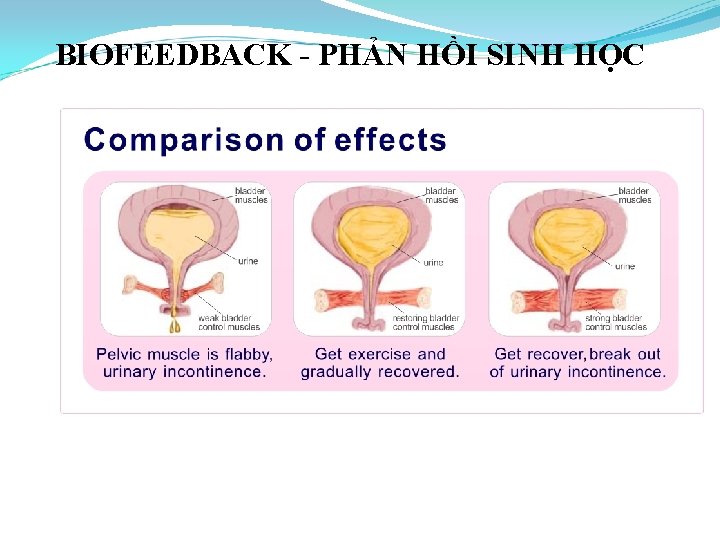 BIOFEEDBACK - PHẢN HỒI SINH HỌC 