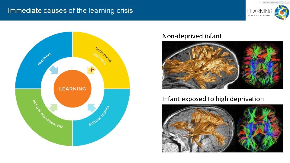 Immediate causes of the learning crisis Non-deprived infant Infant exposed to high deprivation 