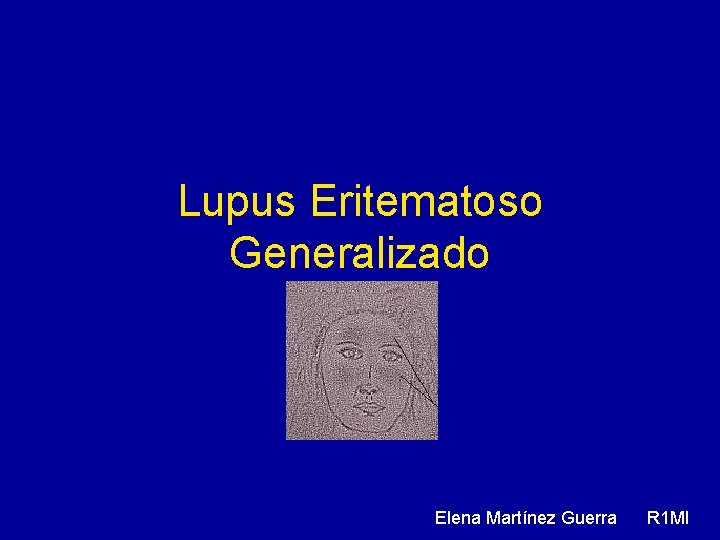 Lupus Eritematoso Generalizado Elena Martínez Guerra R 1 MI 