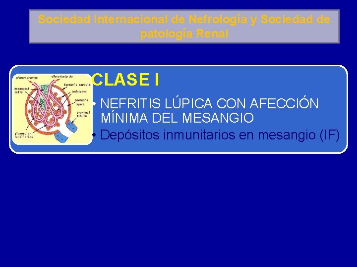 Sociedad Internacional de Nefrología y Sociedad de patología Renal CLASE I • NEFRITIS LÚPICA