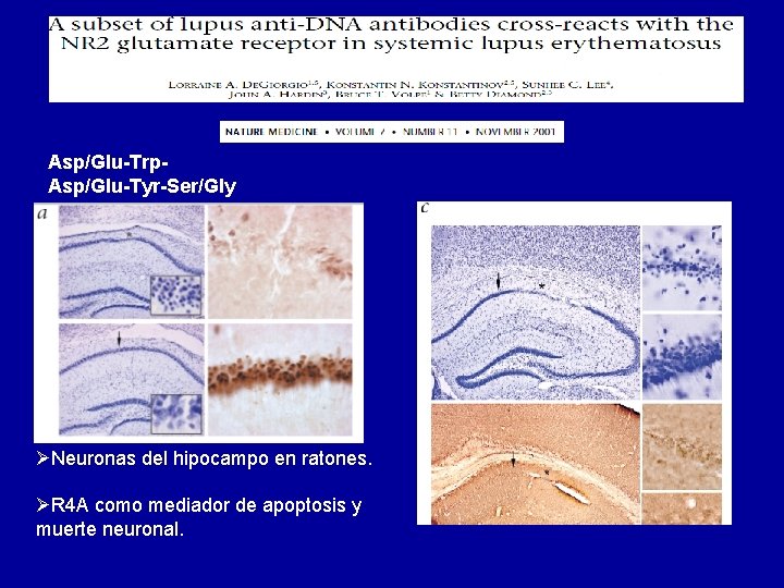 Asp/Glu-Trp. Asp/Glu-Tyr-Ser/Gly ØNeuronas del hipocampo en ratones. ØR 4 A como mediador de apoptosis