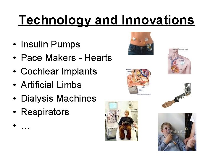 Technology and Innovations • • Insulin Pumps Pace Makers - Hearts Cochlear Implants Artificial Technology and Innovations • • Insulin Pumps Pace Makers - Hearts Cochlear Implants Artificial