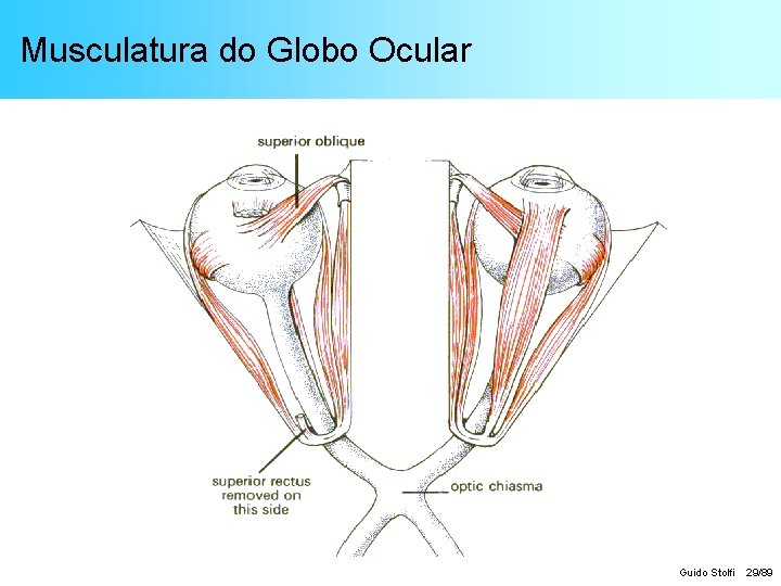 Musculatura do Globo Ocular Guido Stolfi 29/89 