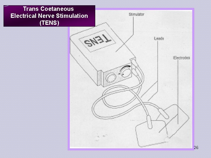 Trans Coetaneous Electrical Nerve Stimulation (TENS) 26 
