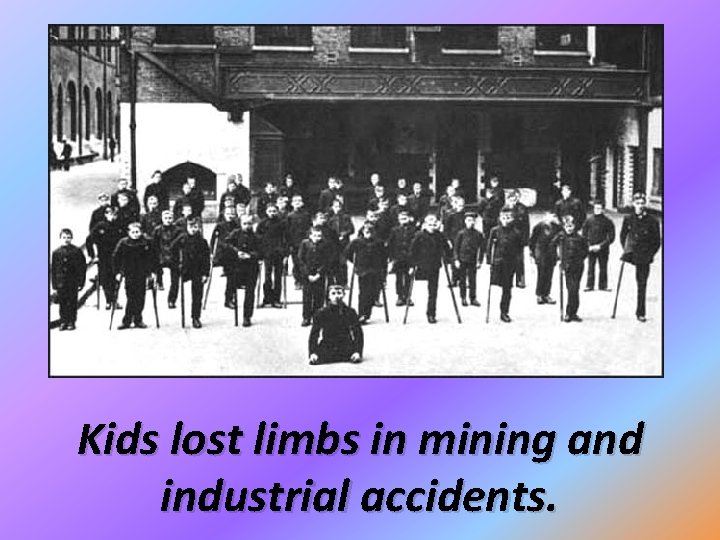 Kids lost limbs in mining and industrial accidents. 