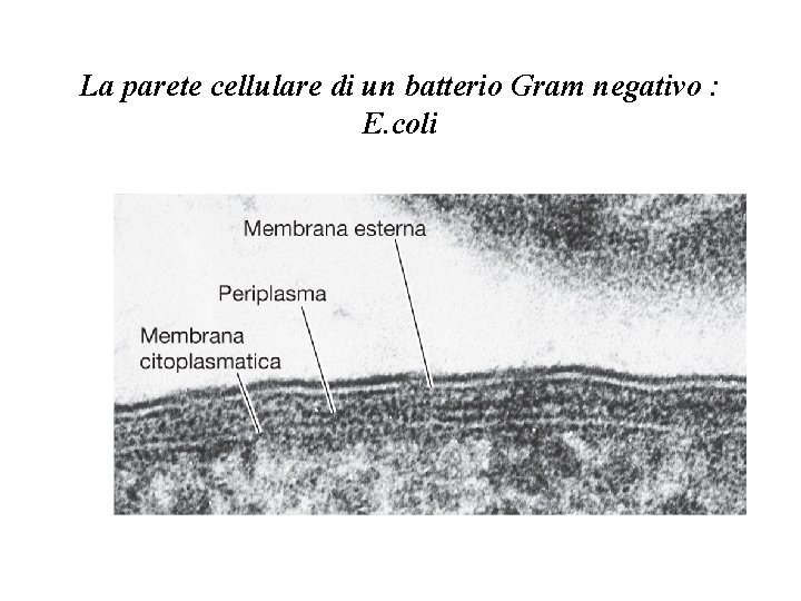 La parete cellulare di un batterio Gram negativo : E. coli 