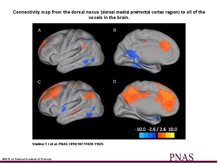 Connectivity map from the dorsal nexus (dorsal medial prefrontal cortex region) to all of
