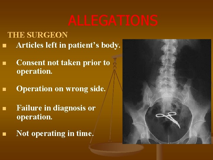 ALLEGATIONS THE SURGEON n Articles left in patient’s body. n Consent not taken prior