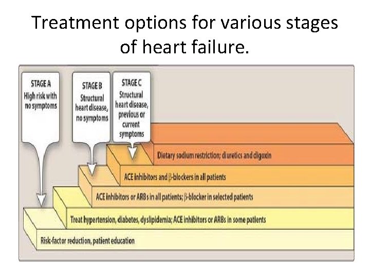 Treatment options for various stages of heart failure. 