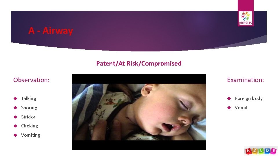 A - Airway Patent/At Risk/Compromised Observation: Examination: Talking Foreign body Snoring Vomit Stridor Choking