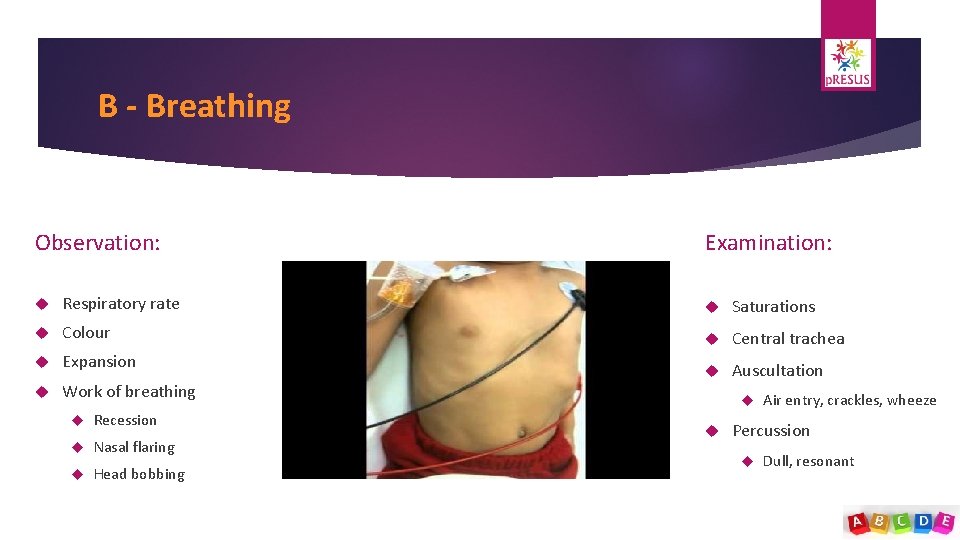 B - Breathing Observation: Examination: Respiratory rate Saturations Colour Central trachea Expansion Work of
