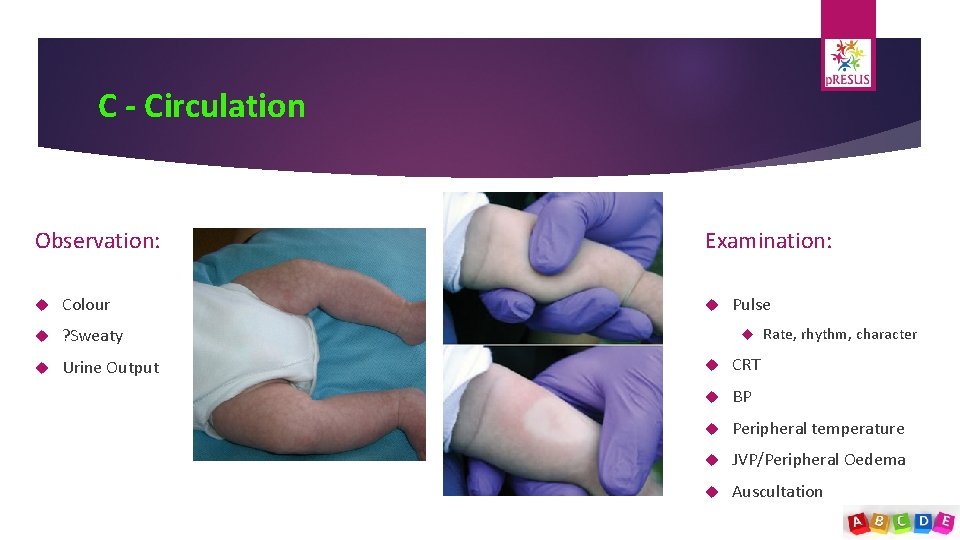 C - Circulation Observation: Colour ? Sweaty Urine Output Examination: Pulse Rate, rhythm, character