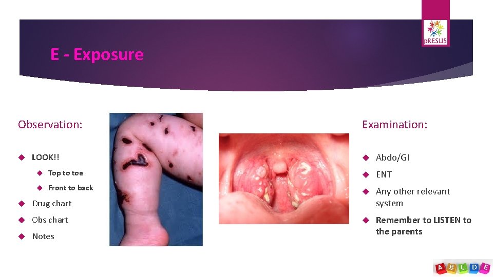 E - Exposure Observation: LOOK!! Examination: Abdo/GI Top to toe ENT Front to back