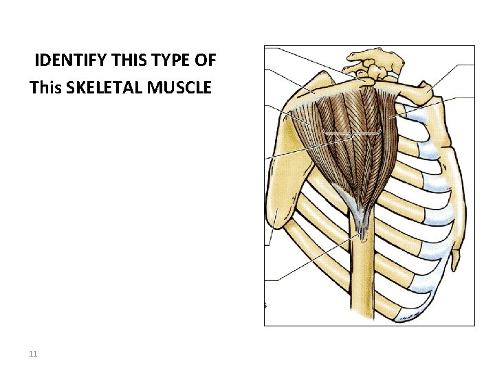 IDENTIFY THIS TYPE OF This SKELETAL MUSCLE 11 
