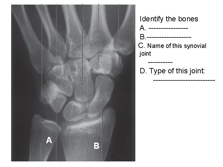 Identify the bones A. --------B. ---------C. Name of this synovial joint -----D. Type of