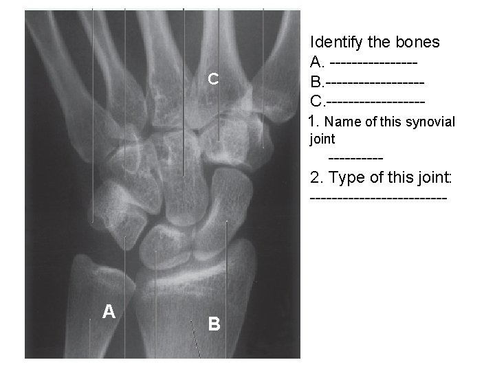 C Identify the bones A. --------B. ---------C. ---------1. Name of this synovial joint -----2.