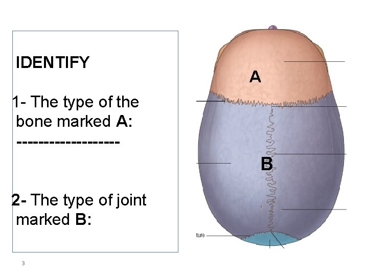 IDENTIFY A 1 - The type of the bone marked A: ---------- B 2