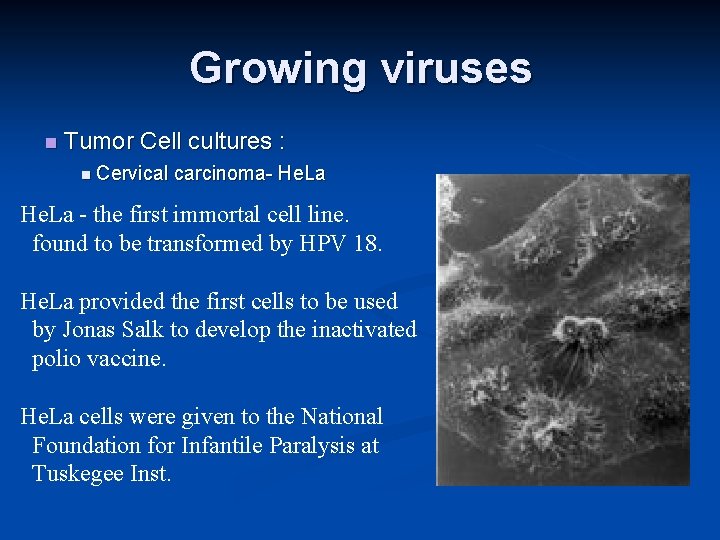 Growing viruses Tumor Cell cultures : Cervical carcinoma- He. La - the first immortal