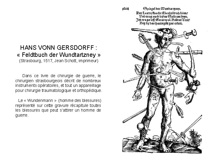 HANS VONN GERSDORFF : « Feldtbuch der Wundtartzney » (Strasbourg, 1517, Jean Schott, imprimeur)