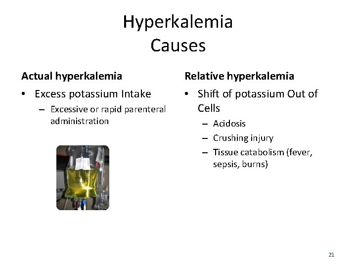 Hyperkalemia Causes Actual hyperkalemia Relative hyperkalemia • Excess potassium Intake • Shift of potassium