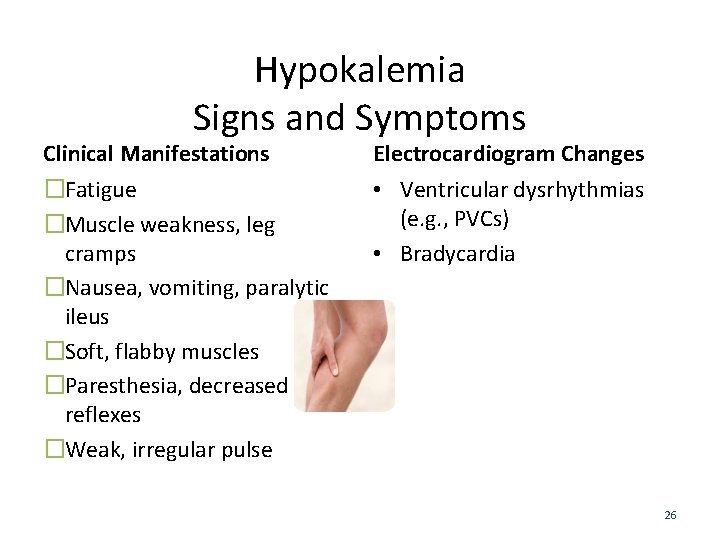 Hypokalemia Signs and Symptoms Clinical Manifestations Electrocardiogram Changes �Fatigue �Muscle weakness, leg cramps �Nausea,