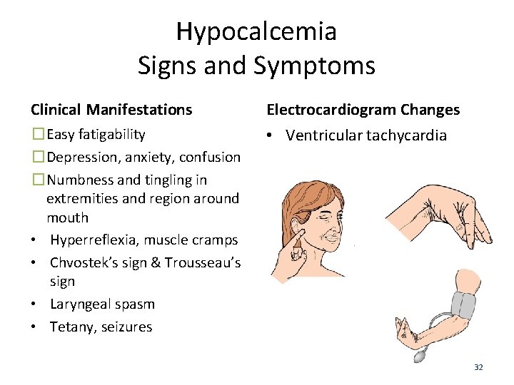 Hypocalcemia Signs and Symptoms Clinical Manifestations Electrocardiogram Changes �Easy fatigability �Depression, anxiety, confusion �Numbness
