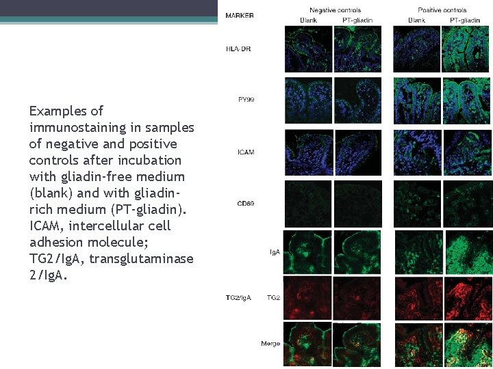 Examples of immunostaining in samples of negative and positive controls after incubation with gliadin-free Examples of immunostaining in samples of negative and positive controls after incubation with gliadin-free