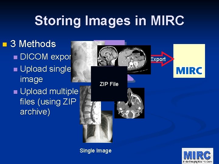Storing Images in MIRC n 3 Methods DICOM export n Upload single image n